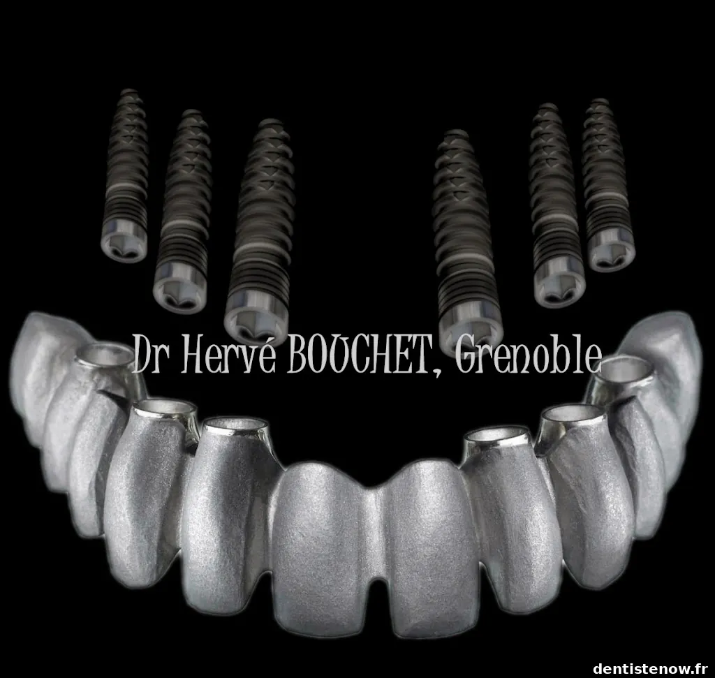 IMPLANTO.com, centre de formation sur l'implant dentaire.