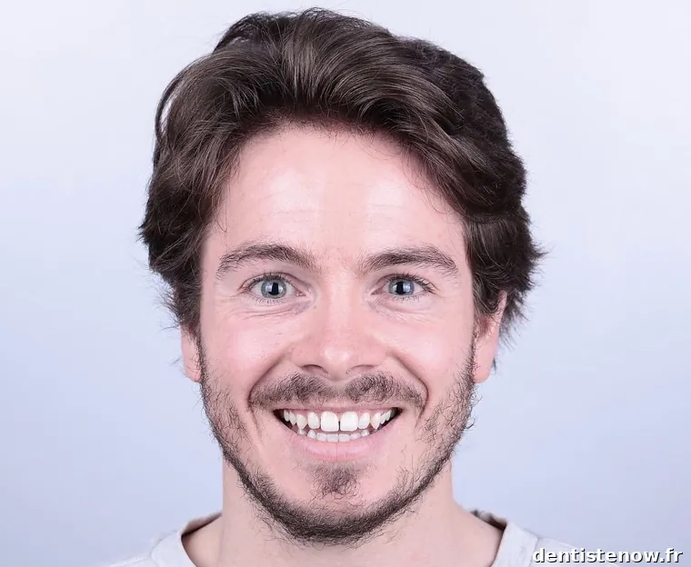 Docteur Nicolas Destrez - Esthétique dentaire