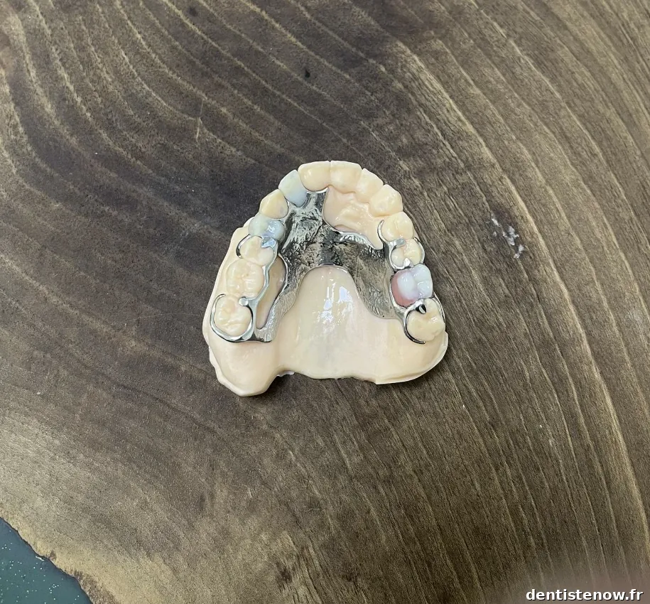 TI LAB Laboratoire de prothèse dentaire Marseille