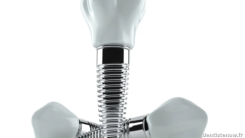 Clinique Implant Dentaire Bois Colombes